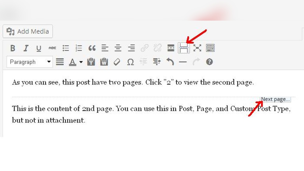 How to Add Next Page Button in Wordpress